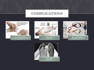 COMPLICATIONS




severe dehydration         Shock     Renal failure




                           Death
 