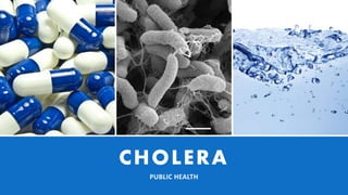 CHOLERA
PUBLIC HEALTH
 