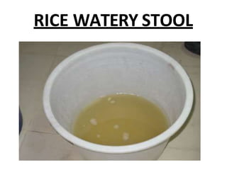 Stool Rice Water Cholera | PPTX