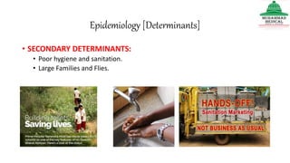 Epidemiology [Determinants]
• SECONDARY DETERMINANTS:
• Poor hygiene and sanitation.
• Large Families and Flies.
 