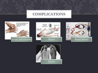 severe dehydration Shock Renal failure
Death
COMPLICATIONS
 