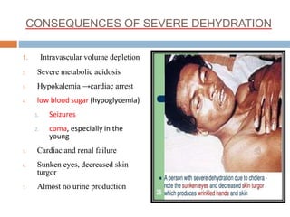 CONSEQUENCES OF SEVERE DEHYDRATION
1. Intravascular volume depletion
2. Severe metabolic acidosis
3. Hypokalemia →cardiac arrest
4. low blood sugar (hypoglycemia)
1. Seizures
2. coma, especially in the
young
5. Cardiac and renal failure
6. Sunken eyes, decreased skin
turgor
7. Almost no urine production