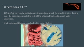 Where does it hit?
Vibrio cholerae rapidly multiply once ingested and attack the small intestine. Toxins
from the bacteria penetrate the cells of the intestinal wall and prevent water
absorption.
If left untreated Cholera can also lead to kidney failure
 