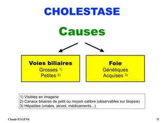 CHOLESTASE
Causes
Claude EUGÈNE !22
Voies biliaires 
Grosses 1) 
Petites 2) 
Foie 
Génétiques
Acquises 3)
1) Visibles en imagerie 
2) Canaux biliaires de petit ou moyen calibre (observables sur biopsie) 
3) Hépatites (virales, alcool, médicaments...)
 