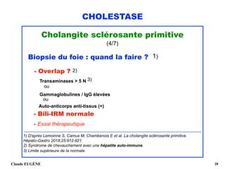 CHOLESTASE
Cholangite sclérosante primitive
(4/7)
Biopsie du foie : quand la faire ? 1)
- Overlap ? 2)
Transaminases > 5 N 3) 
ou
Gammaglobulines / IgG élevées
ou
Auto-anticorps anti-tissus (+)
- Bili-IRM normale 
- Essai thérapeutique
.........................................................................................................................................
1) D'après Lemoinne S, Camus M, Chambenois E et al. La cholangite sclérosante primitive.
Hépato-Gastro 2018;25:912-921.
2) Syndrome de chevauchement avec une hépatite auto-immune.
3) Limite supérieure de la normale. 
Claude EUGÈNE !28
 