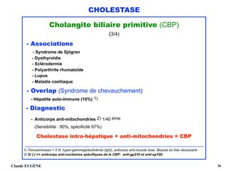 CHOLESTASE
Cholangite biliaire primitive (CBP)
(3/4)
- Associations 
- Syndrome de Sjögren 
- Dysthyroïdie 
- Sclérodermie 
- Polyarthrite rhumatoïde 
- Lupus 
- Maladie coeiliaque 
- Overlap (Syndrome de chevauchement) 
- Hépatite auto-immune (10%) 1)
- Diagnostic 
- Anticorps anti-mitochondries 2) 1/40 ème 
(Sensibilité : 90%, spécificité 97%)
Cholestase intra-hépatique + anti-mitochondries = CBP 
.....................................................................................................................................
1) Transaminases > 5 N, hyper-gammaglobulinémie (IgG), anticorps anti-muscle lisse. Biopsie du foie nécessaire. 
3) Si (-) => anticorps anti-nucléaires spécifiques de la CBP: anti-gp210 et anti-sp100.
Claude EUGÈNE !36
 