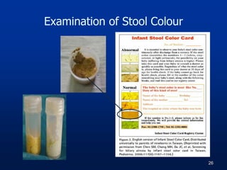 Examination of Stool Colour
26
 