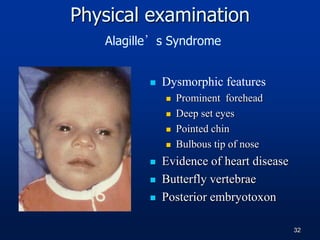 Physical examination
Alagille’s Syndrome
 Dysmorphic features
 Prominent forehead
 Deep set eyes
 Pointed chin
 Bulbous tip of nose
 Evidence of heart disease
 Butterfly vertebrae
 Posterior embryotoxon
32
 