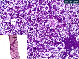 PAS –D STAIN
 