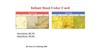 •Sensitivity: 89.7%
•Specificity: 99.9%
Ref: Hsiao et al. Hepatology 2008
 