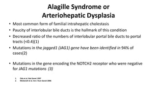 Alagille Syndrome or
Arteriohepatic Dysplasia
• Most common form of familial intrahepatic cholestasis
• Paucity of interlobular bile ducts is the hallmark of this condition
• Decreased ratio of the numbers of interlobular portal bile ducts to portal
tracts (<0.4)(1)
• Mutations in the jagged1 (JAG1) gene have been identified in 94% of
cases(2)
• Mutations in the gene encoding the NOTCH2 receptor who were negative
for JAG1 mutations (3)
1. Oda et al. Nat Genet 1997
2. McDaniell et al. Am J Hum Genet 2006
 