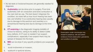 • No lab tests or incisional biopsies are generally needed for
diagnosis.
1. Audiometry can be done prior to surgery. Pure tone
audiometry with air conduction and bone conduction is
the main test we use. The test doesn’t diagnose the
condition, but does tell us how much hearing has been
lost, and whether it is a conductive hearing loss (usually
due to damage to the eardrum and ossicles) or a
sensorineural hearing loss due to damage to the inner
ear.
2. CT scanning is the diagnostic imaging modality of
choice for lesions, owing to its ability to detect subtle
bony defects. A CT scan is needed if we suspect
complications, especially if we suspect there may be
spread of disease into the brain.
3. MRI can be done if very specific problems are suspected
like-
i. dural involvement or invasion,
ii. subdural or epidural abcess,
Examination under microscope may
reveal it’s presence, site and extent,
evidence of bone destruction, granuloma
and condition of ossicles.
 