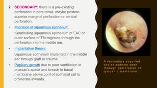A s e c o n d a r y a c q u i r e d
c h o l e s t e a t o m a s e e n
t h r o u g h p e r f o r a t i o n o f
t y m p a n i c m e m b r a n e .
2. SECONDARY: there is a pre-existing
perforation in pars tensa, maybe postero-
superior marginal perforation or central
perforation.
• Migration of squamous epithelium:
Keratinising squamous epithelium of EAC or
outer surface of TM migrates through the
perforation into the middle ear.
• Implantation theory:
Squamous epithelium implanted in the middle
ear through graft or trauma
• Papillary growth due to poor ventillation in
prussac’s space and breach in basal
membrane allows cord of epithelial cell to
proliferate inwards.
 