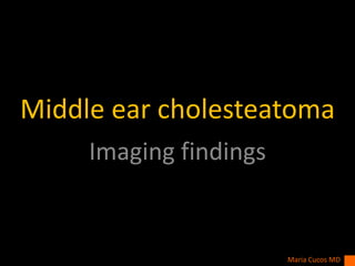 Middle ear cholesteatoma
Imaging findings
Maria Cucos MD
 