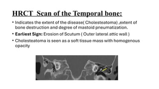 This presentation has Cholesteatoma Management. | PPTX