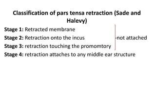Sade Classification CHOLESTEATOMA new.pptx