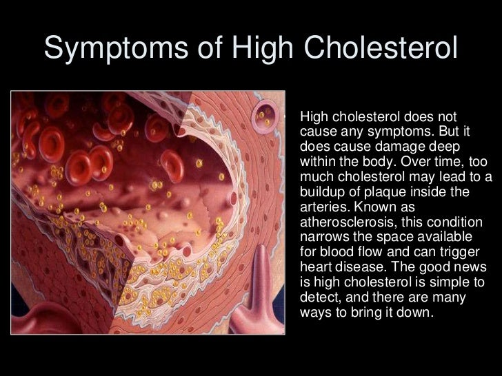 Cholesterol Cholesterol