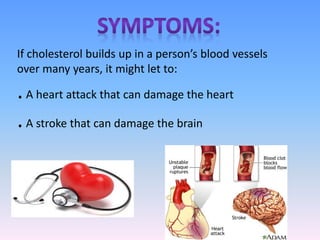 If cholesterol builds up in a person’s blood vessels
over many years, it might let to:
.A heart attack that can damage the heart
.A stroke that can damage the brain
