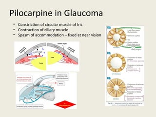 Pilocarpine in Glaucoma
• Constriction of circular muscle of Iris
• Contraction of ciliary muscle
• Spasm of accommodation – fixed at near vision
 