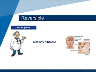 www.company.com 
Reversible 
Rivastigmine 
Alzheimer disease 
 