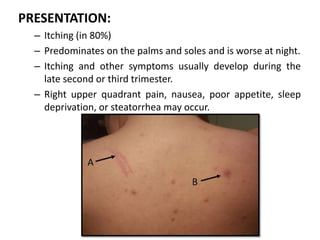 cholestsis.pptx