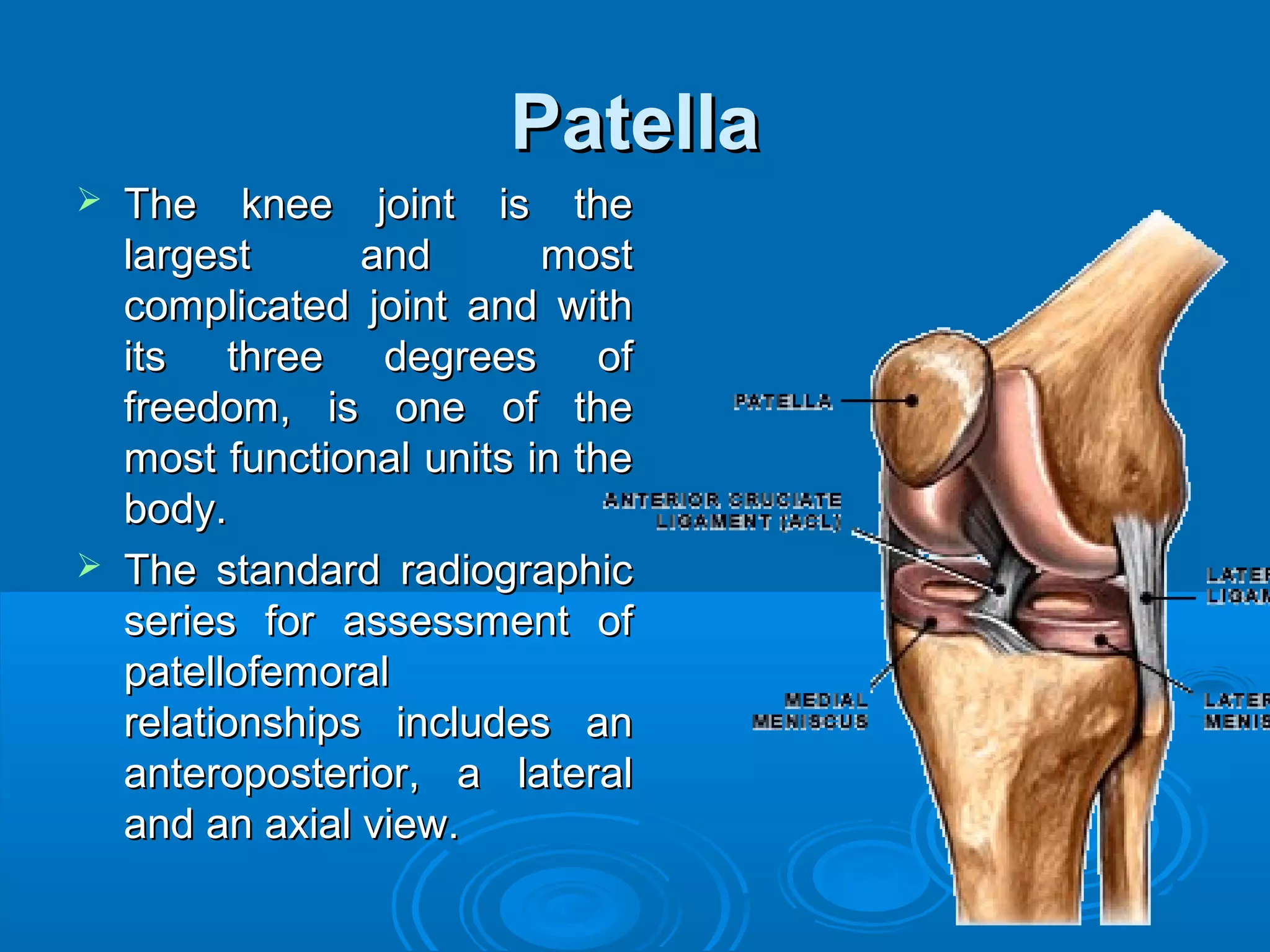 Chondromalacia patella