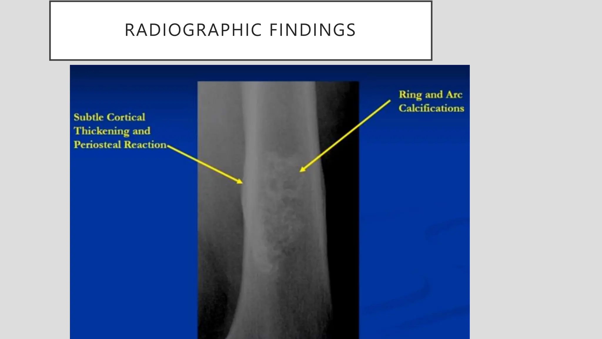 RADIOGRAPHIC FINDINGS
 