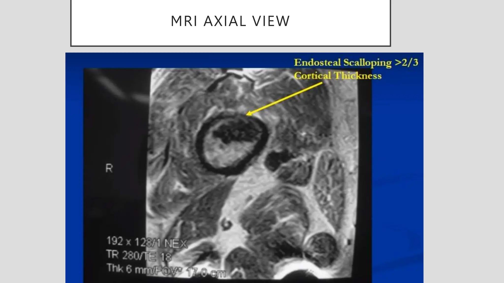 MRI AXIAL VIEW
 