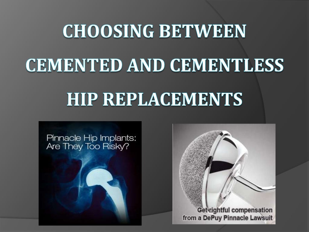 Choosing between cemented and cementless hip replacements