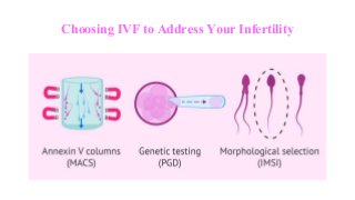 Choosing IVF to Address Your Infertility
 