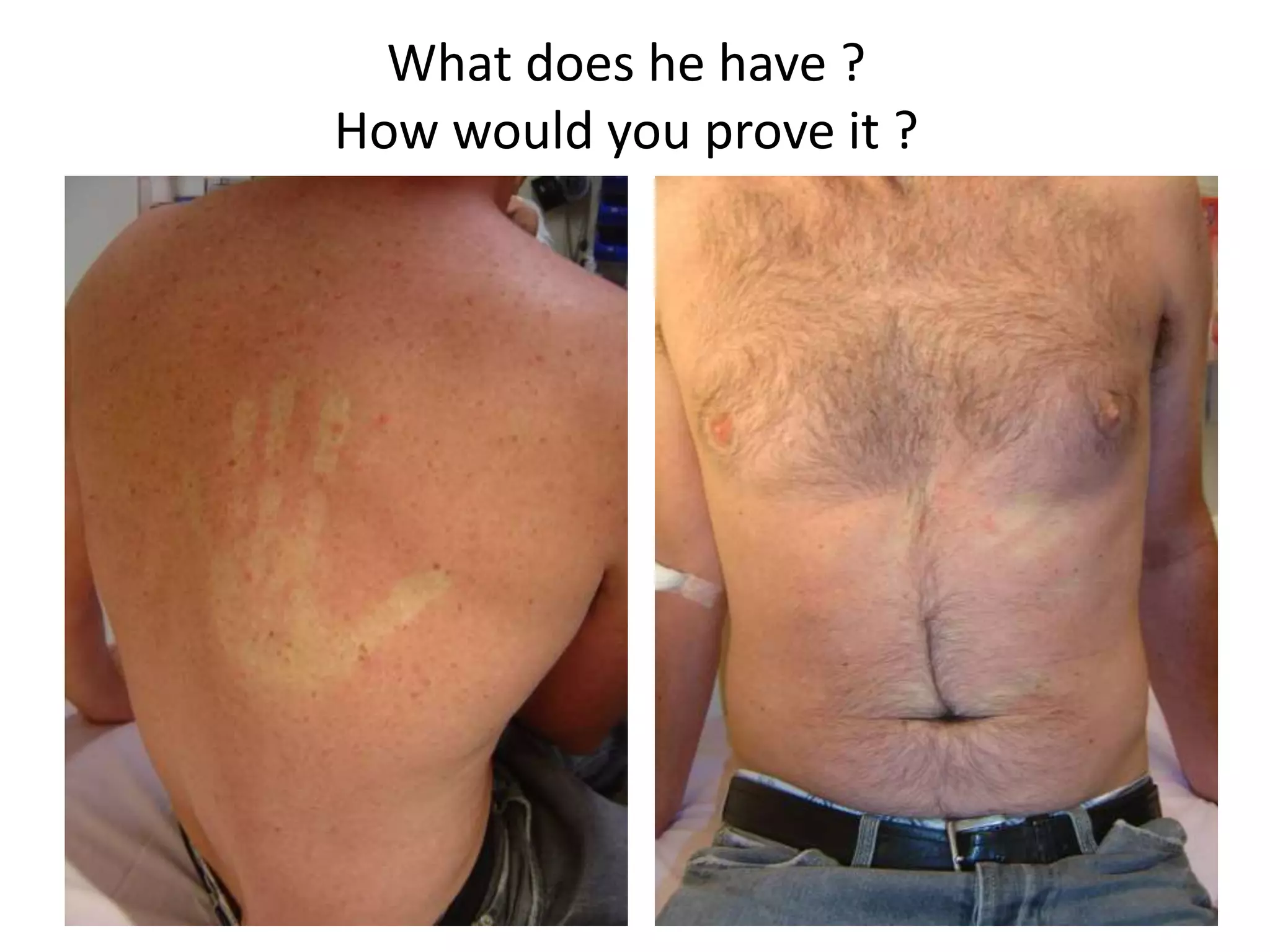 1179838
What does he have ?
How would you prove it ?
 