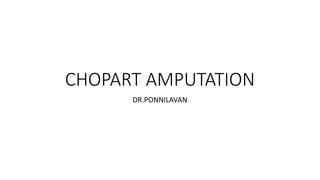 CHOPART AMPUTATION
DR.PONNILAVAN
 