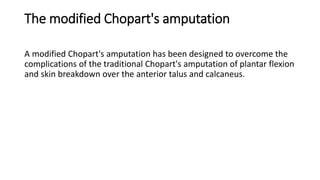 Chopart amputation | PPTX