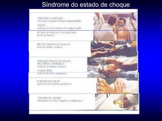 Síndrome do estado de choque
 