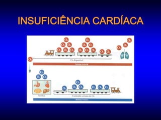 INSUFICIÊNCIA CARDÍACA
 