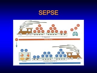 SEPSE
 