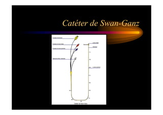 Catéter de Swan-Ganz
 