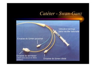 Catéter - Swan-Ganz
 