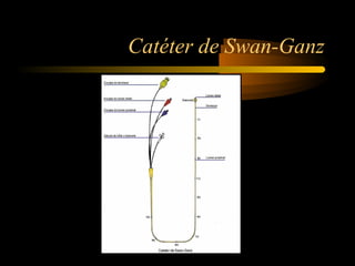 Catéter de Swan-Ganz
 
