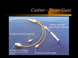 Catéter - Swan-Ganz
 