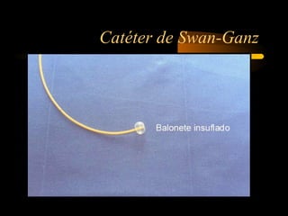 Catéter de Swan-Ganz
 