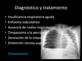 Diagnóstico y tratamiento
•
•
•
•
•
•

Insuficiencia respiratoria aguda
Enfisema subcutáneo
Ausencia de ruidos respiratorios
Timpanismo a la percusión
Desviación de la tráquea
Distención venosa yugular
Toracostomía

 
