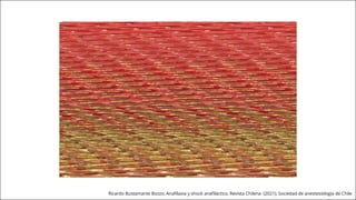 Ricardo Bustamante Bozzo, Anafilaxia y shock anafiláctico, Revista Chilena (2021), Sociedad de anestesiología de Chile
 