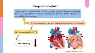 Choque Cardiogênico
Caracteriza-se por uma situação de hipoperfusão tecidual sistêmica ocasionada,
devido a incapacidade do músculo cardíaco em fornecer débito adequado as
necessidades do organismo.
Pode ser ocasionado por uma disfunção Intrínsecas ou Extrínsecas
40% massa muscular do V.E
PAS 90 mmHg
Imagem: Brasilescola.com.br
 