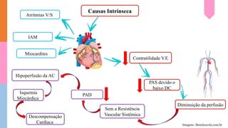 Causas Intrínseca
Arritmias V/S
IAM
Miocardites
Contratilidade V.E
PAS devido o
baixo DC
Diminuição da perfusão
Sem a Resistência
Vascular Sistêmica
PAD
Hipoperfusão da AC
Isquemia
Miocárdica
Descompensação
Cardíaca Imagens: Brasilescola.com.br
 
