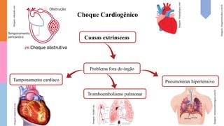 Choque Cardiogênico
Problema fora do órgão
Causas extrínsecas
Tamponamento cardíaco Pneumotórax hipertensivo
Imagens:
imagensemoldes.com.br
Imagem:sanarmed.com
Imagem:
freepnglogos.com
Tromboembolismo pulmonar
Imagem:
medpri.me
Imagem:
minutoenfermagem.com.br
Imagem:
edwards.com
 