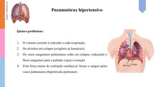 Pneumotórax hipertensivo
Quatro problemas:
1. O volume corrente é reduzido a cada respiração;
2. Os alvéolos em colapso (oxigênio as hemácias);
3. Os vasos sanguíneos pulmonares estão em colapso, reduzindo o
fluxo sanguíneo para o pulmão e para o coração
4. Uma força maior de contração cardíaca p/ forçar o sangue pelos
vasos pulmonares (hipertensão pulmonar).
Imagem:
sanarmed.com
 