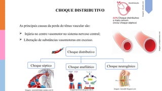 As principais causas da perda do tônus vascular são:
 Injúria no centro vasomotor no sistema nervoso central;
 Liberação de substâncias vasomotoras em excesso.
Choque distributivo
Choque neurogênico
Choque anafilático
Choque séptico
CHOQUE DISTRIBUTIVO
Imagem:
pt.thpanorama.com
Imagens: sustentabilidade.estadao.com.br Imagem:professor.pucgoias.edu.br Imagem: lannufpb.blogspot.com
Imagem:
edwards.com
 