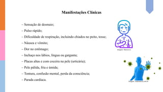 – Sensação de desmaio;
– Pulso rápido;
– Dificuldade de respiração, incluindo chiados no peito, tosse;
– Náusea e vômito;
– Dor no estômago;
– Inchaço nos lábios, língua ou garganta;
– Placas altas e com coceira na pele (urticária);
– Pele pálida, fria e úmida;
– Tontura, confusão mental, perda da consciência;
– Parada cardíaca.
Manifestações Clínicas
Imagem: flaticon.es
Imagem: todamateria.com.br
 