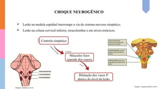 CHOQUE NEUROGÊNICO
 Lesão na medula espinhal interrompe a via do sistema nervoso simpático;
 Lesão na coluna cervical inferior, toracolombar e em níveis torácicos.
Controle simpático
Sistem
a vascular
A
perda
Músculos lisos
(parede dos vasos)
Dilatação dos vasos P.
abaixo do nível da lesão
Controla
ocorre
Imagens: imagensemoldes.com.br
Imagem: docplayer.com.br
 
